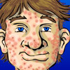 play Squeezing Zits