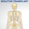play Skeleton Transplant
