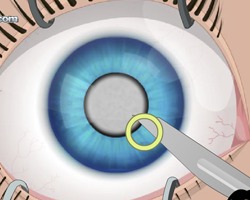 play Eye Surgery