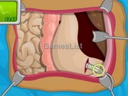 Operate Now: Stomach Surgery