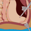 Operate Now Stomach Surgery game
