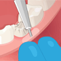 play Dental Surgery