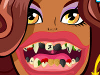 play Clawdeen Wolf Bad Teeth