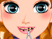 play Frozen Anna Dentist