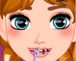 play Frozen Anna Dentist