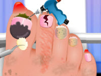 play Nail Surgery Foot Spa