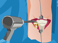 play Leg Lengthening Operation