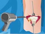 play Aime Leg Lengthening Operation