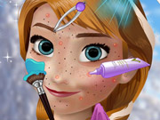 play Anna Great Makeover