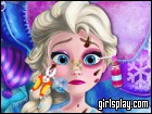 play Injured Elsa Frozen