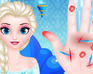 play Doctor Frozen Elsa Hand