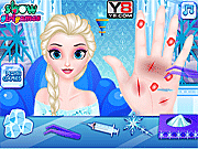 play Doctor Frozen Elsa Hand