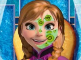 play Anna Frozen Makeover