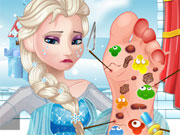 play Elsa Foot Doctor 2