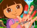 Dora Hand Injuries