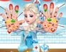 play Elsa Hand Doctor