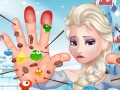play Elsa Hand Doctor