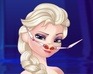 Elsa Nose Problems