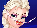 Elsa Nose Problems