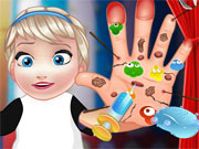 play Baby Elsa Hand Doctor