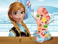 play Anna Foot Doctor