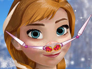 Anna Nose Problems