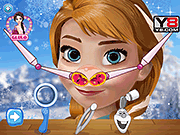 play Anna Nose Doctor