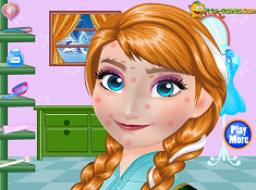 play Anna Makeover 2016