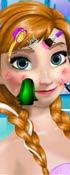 play Anna Skin Care Game