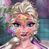 play Elsa Skin Doctor