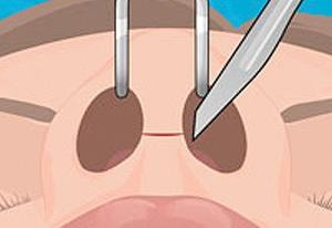 play Operate Now: Nose Surgery