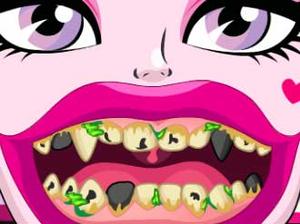 play Draculaura Bad Teeth