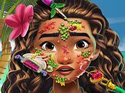 play Moana Skin Doctor