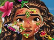 play Moana Skin Doctor