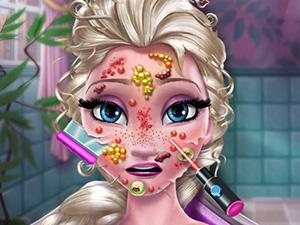 play Ice Queen Skin Doctor