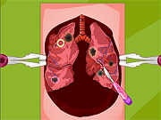 play Mori'S Lung Surgery Game