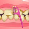 Bad Teeth Makeover