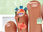 play Nail Doctor