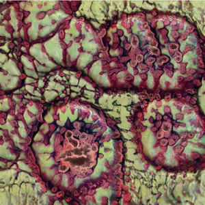 Cytotoxicity, Errant Stigma, Dispersal Method Resulting In Necrosis Of Host