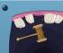 play Teeth Smasher