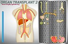 play Organ Transplant 2