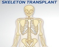 play Skeleton Transplant