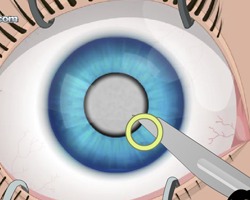 play Eye Surgery