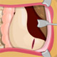 play Operate Now : Stomach Surgery