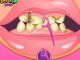 play Bad Teeth Makeover