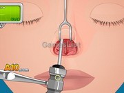 Operate Now: Nose Surgery