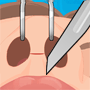 Nose Surgery