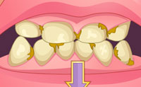 play Bad Teeth Makeover