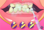 play Bad Teeth Makeover