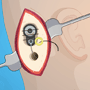 play Ear Surgery
